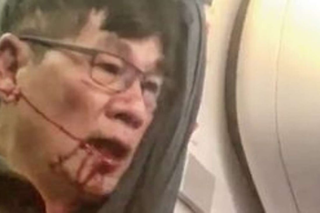 A passenger, his face bloodied and bruised, is dragged from a United Airlines flight in Chicago on Sunday. Photo: Twitter