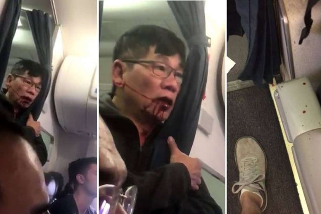 Images of David Dao, the passenger who was violently ejected from the United Airlines flight in Chicago. Photo: Handout