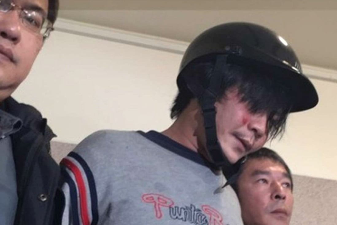 Wang Ching-yu pictured last year after the attack. Photo: Handout
