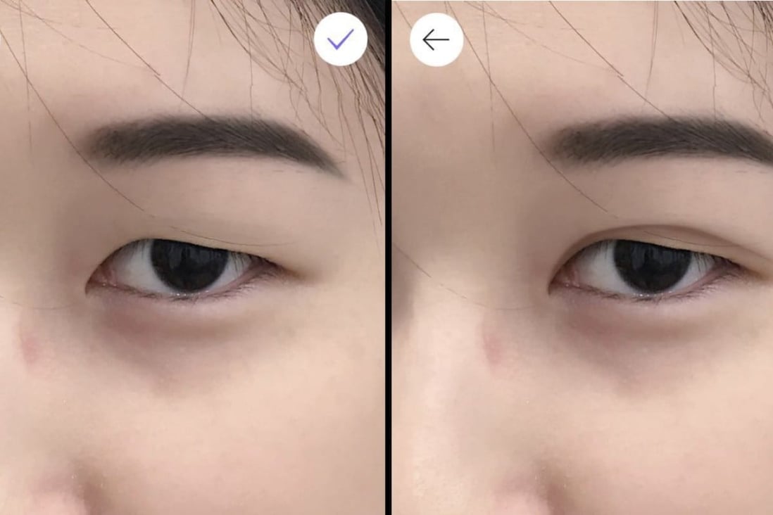 An image of reporter Viola Zhou, taken on smartphone app MakeupPlus, shows a before (left) and after comparison using the double eyelid filter. Photo: SCMP