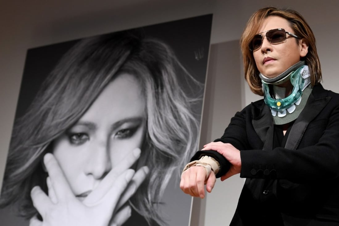 Yoshiki from the Japanese band X Japan wears a neck brace while attending a press conference in Tokyo. Photo: AFP