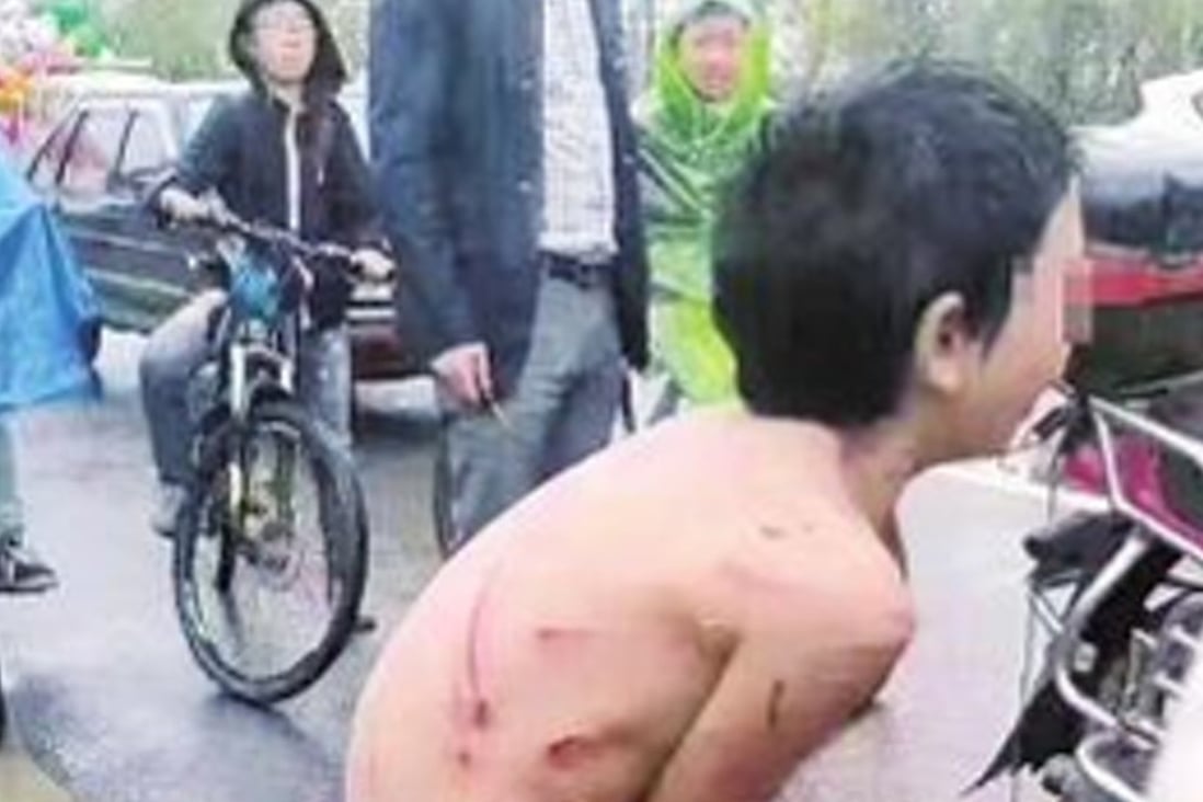 A video of a naked boy covered in welts and being pulled through the streets on the end of a rope attached to his father’s motorbike has sparked outrage online. Photo: Handout