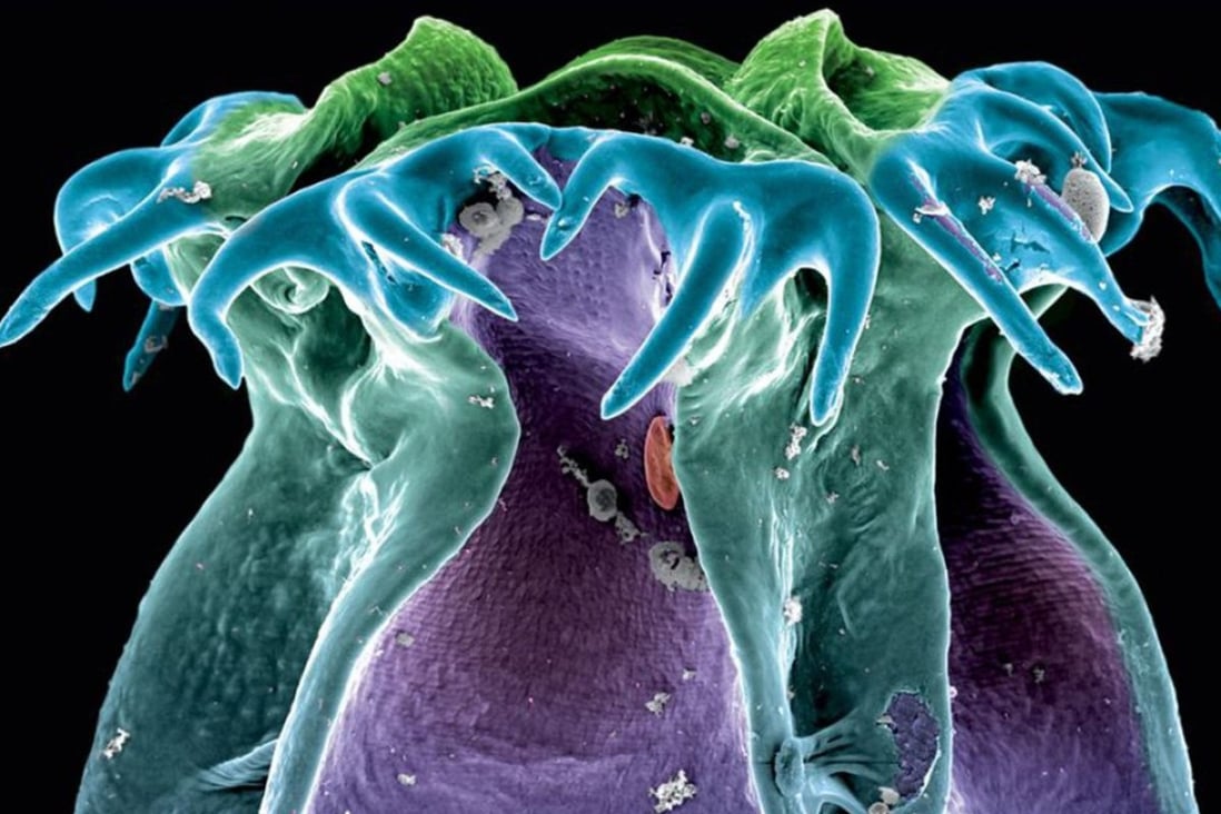 dentist tapeworm simptome de viermi la copii mici