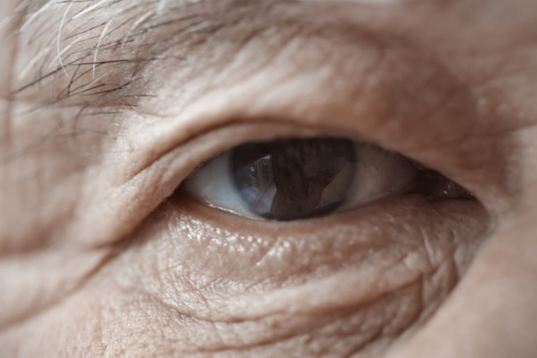 Close-up view on the eye of elderly human. [23MAR2015 BROADSHEET HEALTH] Shutterstock 256119382