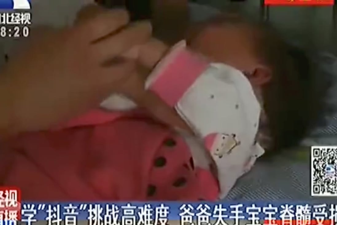 The toddler injured in the accident. Photo: News.163.com