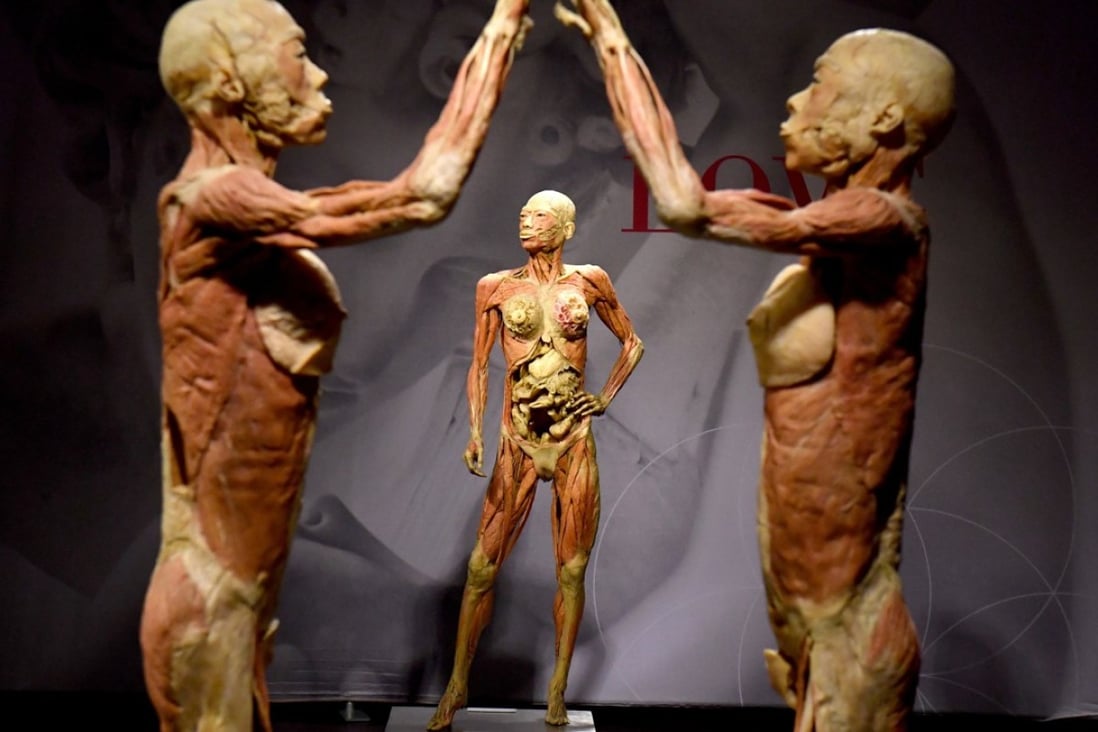 An exhibit from the Real Bodies exhibition in Sydney. Protesters have suggested the cadavers on display could be thouse of executed Chinese prisoners. Photo: EPA-EFE