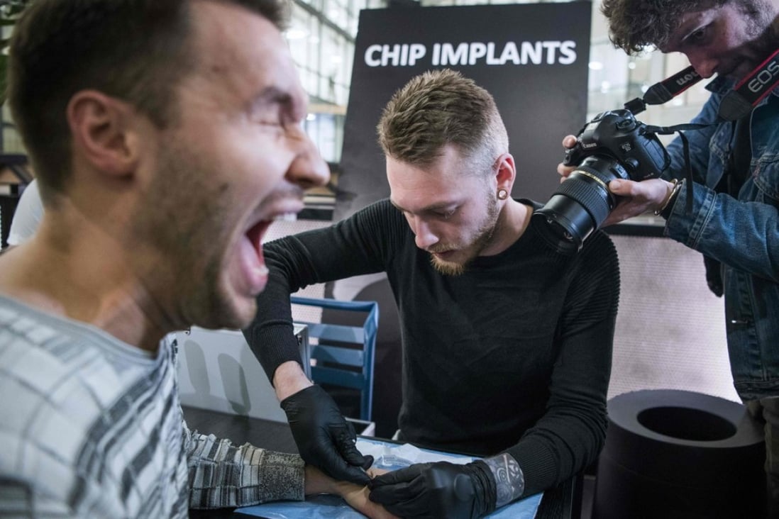 A man winces as he gets a chip implant in his hand. Photo: AFP