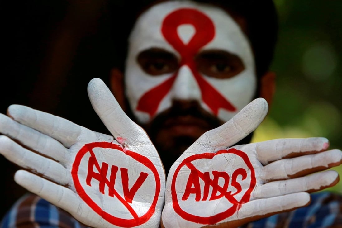 A student displays his hands painted with messages as he poses during an HIV/Aids awareness campaign to mark the International Aids Candlelight Memorial, in Chandigarh, India, on May 20. Photo: Reuters