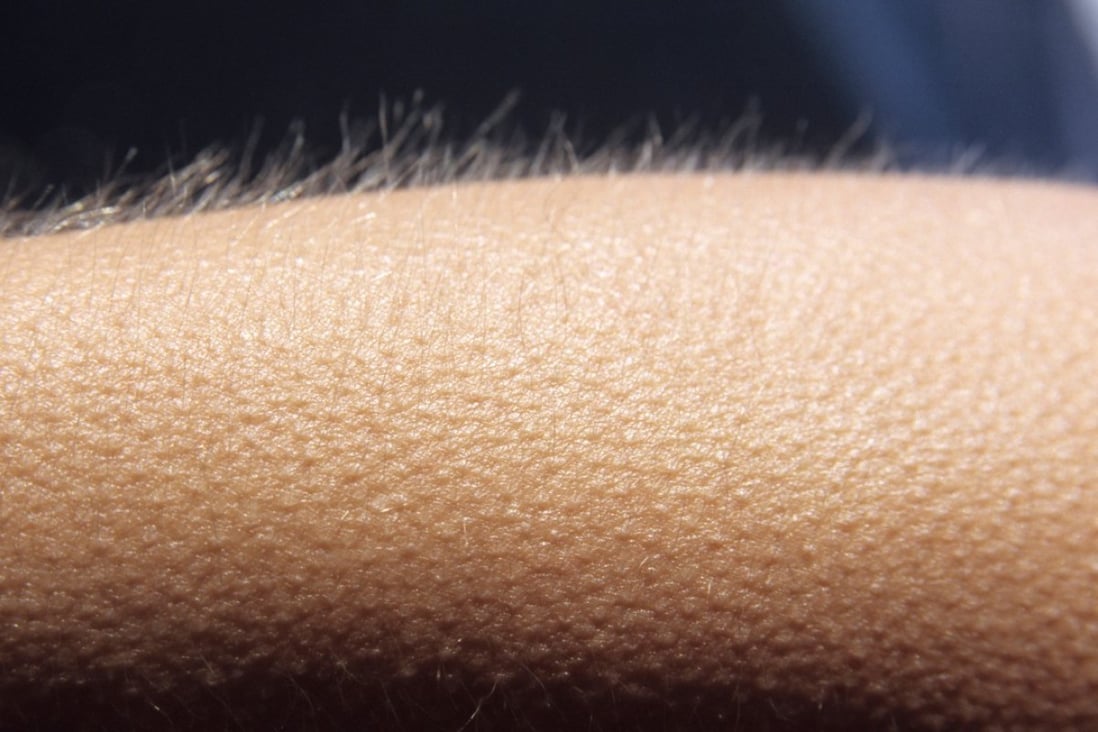 Halloween Goosebumps Shivers And Skin Orgasms And Why We Love To Feel That Frisson South China Morning Post Here are all the possible meanings and translations of the word goosebumps. halloween goosebumps shivers and skin