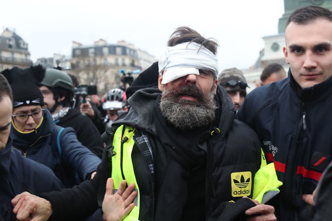 Jerome Rodrigues, one of the leaders of the yellow vest movement, is led away after getting injured in the eye during clashes between protesters and riot police in Paris on January 26, 2019. Photo: AFP
