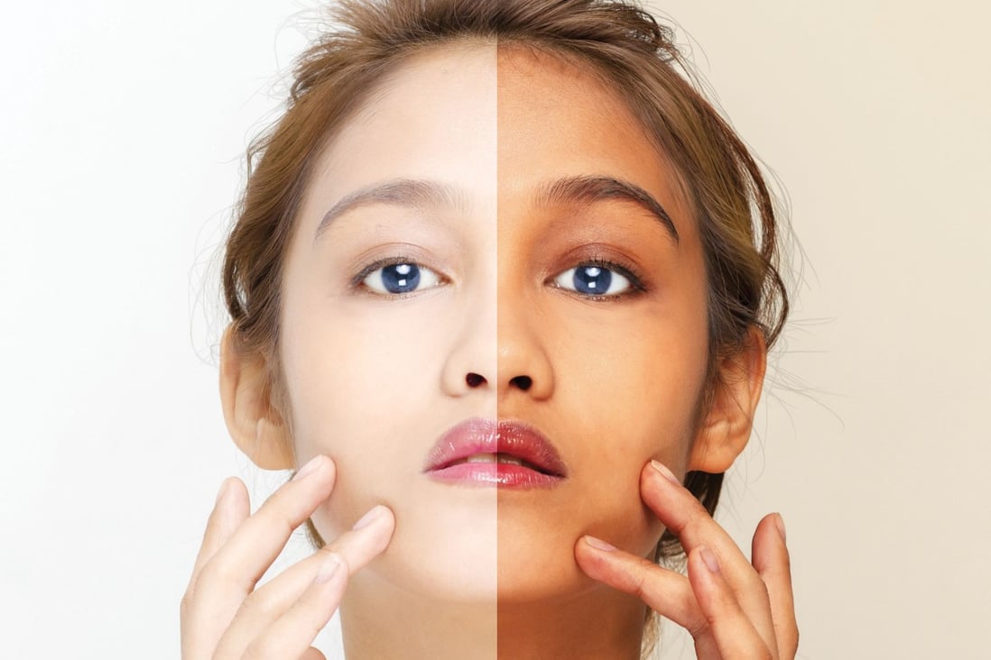 A World Health Organisation survey found that nearly 40 per cent of women polled in nations including China, Malaysia, the Philippines and South Korea said they regularly used whitening products. Photo: Shutterstock