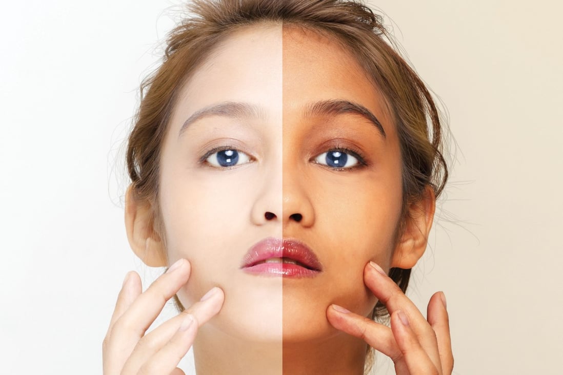 Asia's addiction to whiter skin runs deep – but the backlash has begun | South China Morning Post
