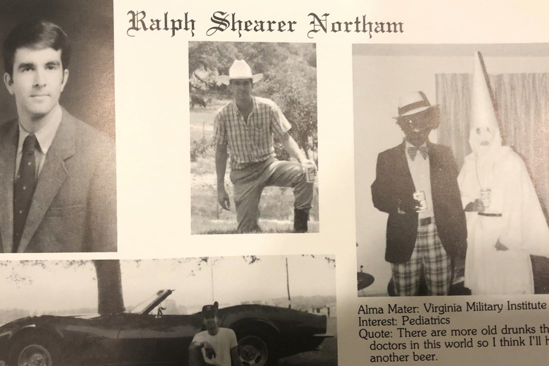 This image shows Virginia Gov. Ralph Northam’s page in his 1984 Eastern Virginia Medical School yearbook. The page shows a picture, at right, of a person in blackface and another wearing a Ku Klux Klan hood next to different pictures of the governor. It's unclear who the people in the picture are, but the rest of the page is filled with pictures of Northam and lists his undergraduate alma mater and other information about him. Photo: Eastern Virginia Medical School via AP
