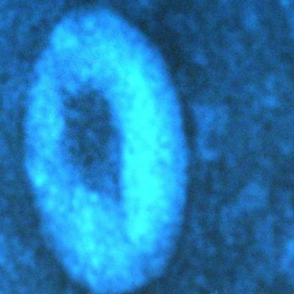 Sars coronavirus. Photo: AP