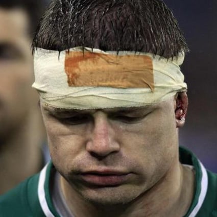 Ireland's Brian O'Driscoll after drawing with France. Photo: Reuters