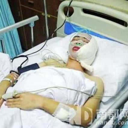 Photo from nandu.com, of the injured chengguan official in hospital. 