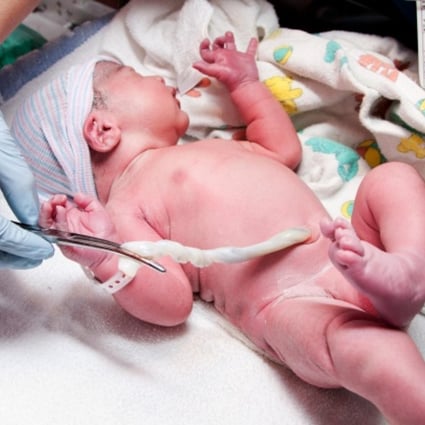 Cutting The Cord Too Soon Bad For Babies South China Morning Post