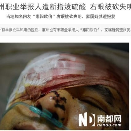 Photo shows the injured Li Jianxin in hospital