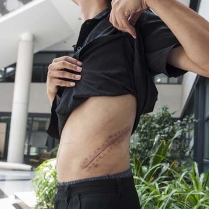Blindfolded and in pain: Chilling details of illegal kidney traffickers revealed | South China Morning Post Blindfolded and in pain: Chilling details of illegal kidney traffickers revealed | South China Morning Post