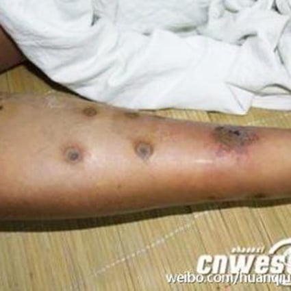 Swarms of hornets have killed 42 people in northwestern China. Photo: Weibo Screenshot