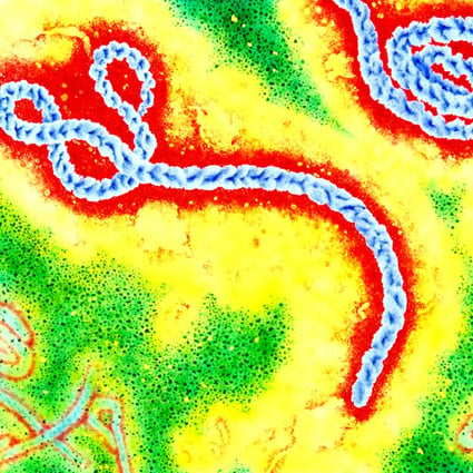 The virus under an electron microscope. Ebola outbreaks are relatively rare, and of little interest to drugmakers. Image: SCMP