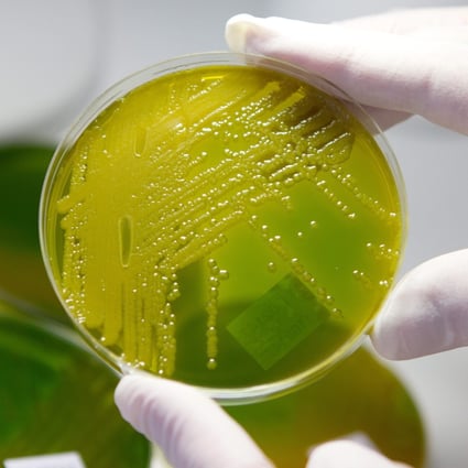 In China, treatment for Escherichia coli using antibiotics is now ineffective in as many as 70 per cent of patients.