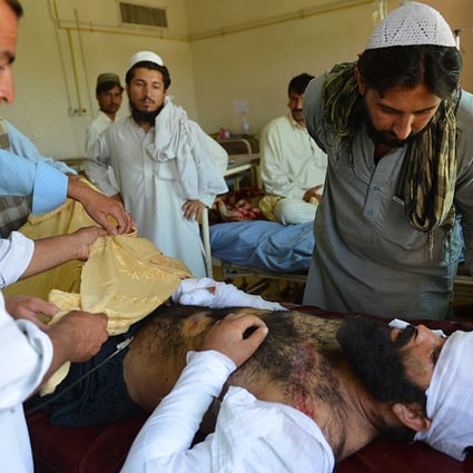 An injured tribesman arrives at a hospital from North Waziristan, following operations by the Pakistan army. Photo: AFP