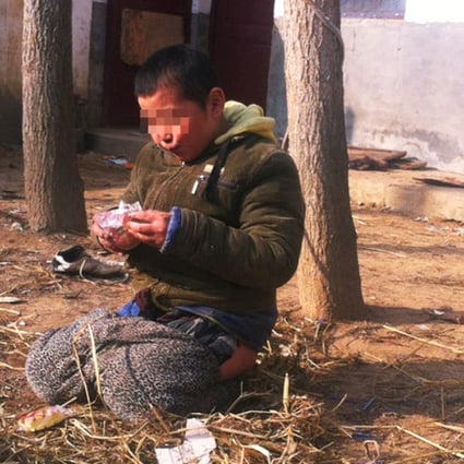 A child eats while tethered to a tree with rope in the shelter's backyard. Photos: Weibo