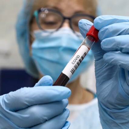 Covid 19 Antibody Test What Does Your Result Mean Why A High Score Is Good But Doesn T Tell The Whole Story South China Morning Post