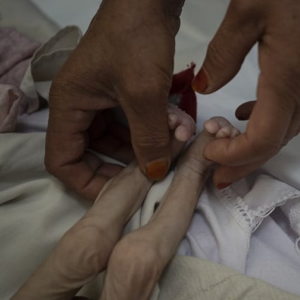 The stepmother of Mohammed, a four-month-old who is malnourished, holds his legs in the Indira Gandhi hospital in Kabul, Afghanistan on November 8.The number of people living in Afghanistan in near-famine conditions has risen to 8.7 million, according to the World Food Programme. Photo: AP