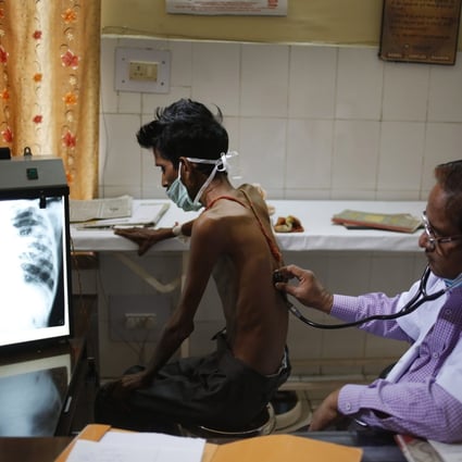 A doctor examines a tuberculosis patient in a hospital in Allahabad, India, in March 2014. As the world focuses on the pandemic, experts fear losing ground in the long fight against other deadly infectious diseases such as TB, malaria and HIV. Photo: AP