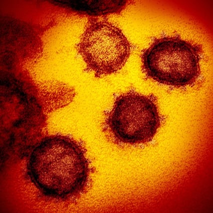 Hong Kong has recorded its first known case of a new strain of the coronavirus first identified in Botswana. Photo: AP