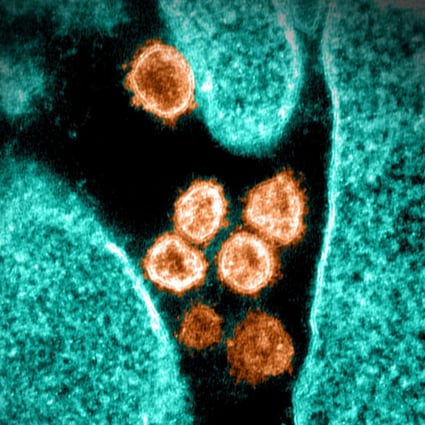 An electron microscope image shows the Sars-CoV-2 virus that causes Covid-19 emerging from the surface of a cell cultured in the lab. Image: National Institute of Allergy and Infectious Diseases via AFP