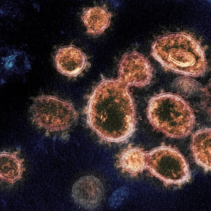 The US has repeatedly criticised China as not being forthcoming on the origins of the coronavirus. Photo: AP
