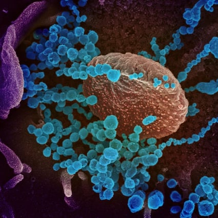 An electron microscope image of the original Covid-19 coronavirus (round blue objects) emerging from the surface of cells cultured in the lab. Photo: NIH via AFP 