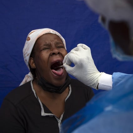 A throat swab is taken from a patient to test for Covid-19 at a facility in Soweto, South Africa. Photo: AP