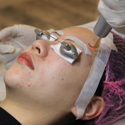 Micro-procedures -- from laser facials and fillers to thread lifts -- are fast becoming the norm in China’s cities where disposable incomes have jumped. Photo: AFP