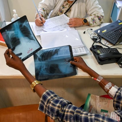 A TB patient holds his chest X-rays during a consultation with a doctor at the Médecins Sans Frontières clinic in Mumbai earlier this month. Photo: AFP