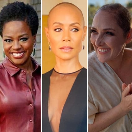 Besides Jada Pinkett Smith, these 10 other celebs have all opened up about having alopecia too. Photos: @gailporter, @violadavis, @jadapinkettsmith, @rickilake, @selmablair/Instagram