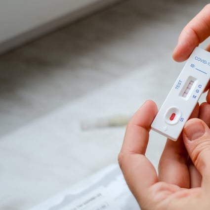 A biotech company has launched a platform to allow patients self-isolating at home in Hong Kong to check their Covid-19 viral load through photos of rapid test kits. Photo: Shutterstock Images