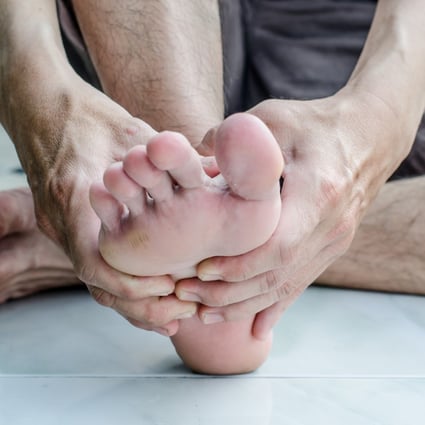 An ingrown toenail can be painful and prevent you from running. Photo: Shutterstock 