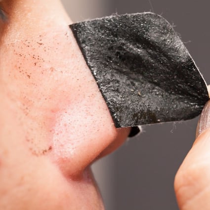 A woman uses a clear-up strip to remove blackheads from around her nose. Up to 20 per cent of adults have blackheads, say experts, the result of clogged pores. Photo: Shutterstock