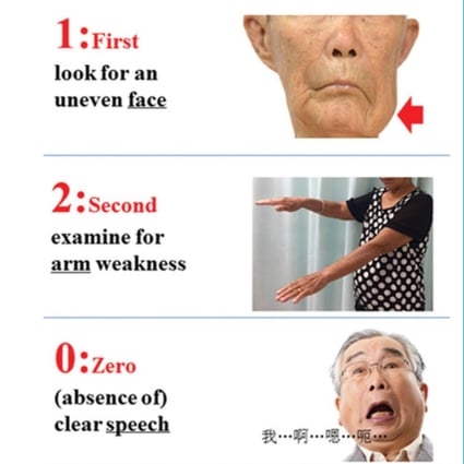 The Stroke 120 campaign uses the medical emergency number in China to represent three steps to check for symptoms. Photo: Handout