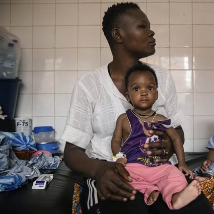 Malnourished children wait for treatment in the paediatric department of Boulmiougou hospital in Ouagadougou, Burkina Faso. The UN is warning that 18 million people in Africa’s Sahel region face severe hunger in the next three months. Photo: AP