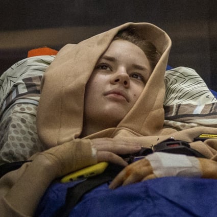 Nastia Kuzik, 21, lies on a stretcher in a hospital elevator in Kyiv, Ukraine on May 5. Photo: AP