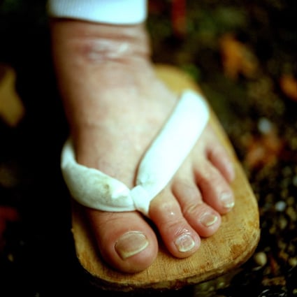 Salespeople in Zimbabwe have been wearing sandals to defy rumours they are involved in the alleged trade of human toes for witchcraft. Picture: Vera Hartmann