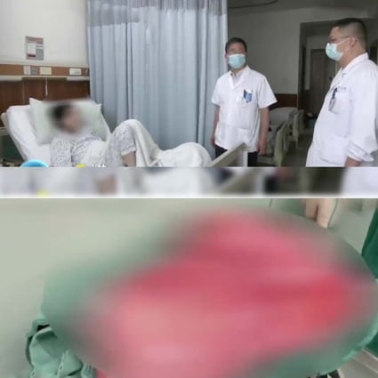 A woman in China thought she was gaining weight, but it turned out to be a stomach tumour. Photo: SCMP composite