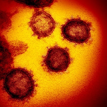 Hong Kong research team’s discovery points to new treatments for coronaviruses such as the one that causes Covid-19. Photo: AP