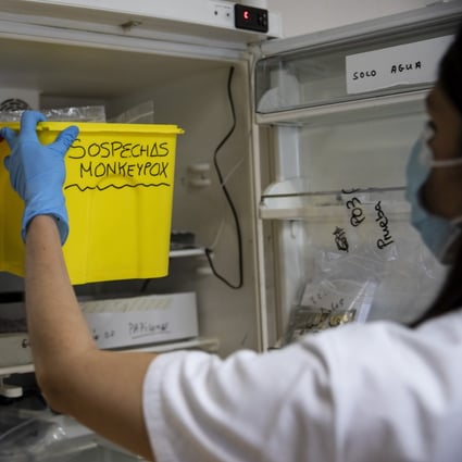 A medical laboratory technician picks up from a fridge a bucket with suspected monkeypox samples to be tested at a microbiology laboratory. Photo: Getty Images