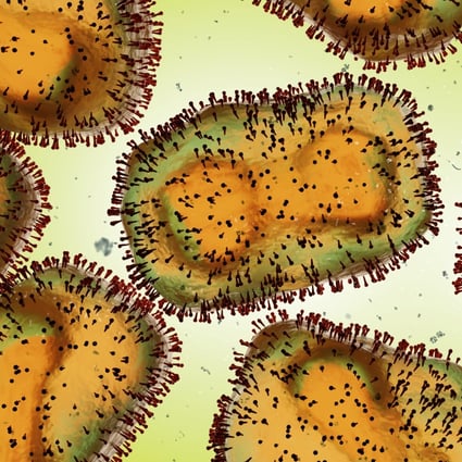 Monkeypox virus, one of the human orthopoxviruses, pathogen closeup. Photo: Shutterstock
